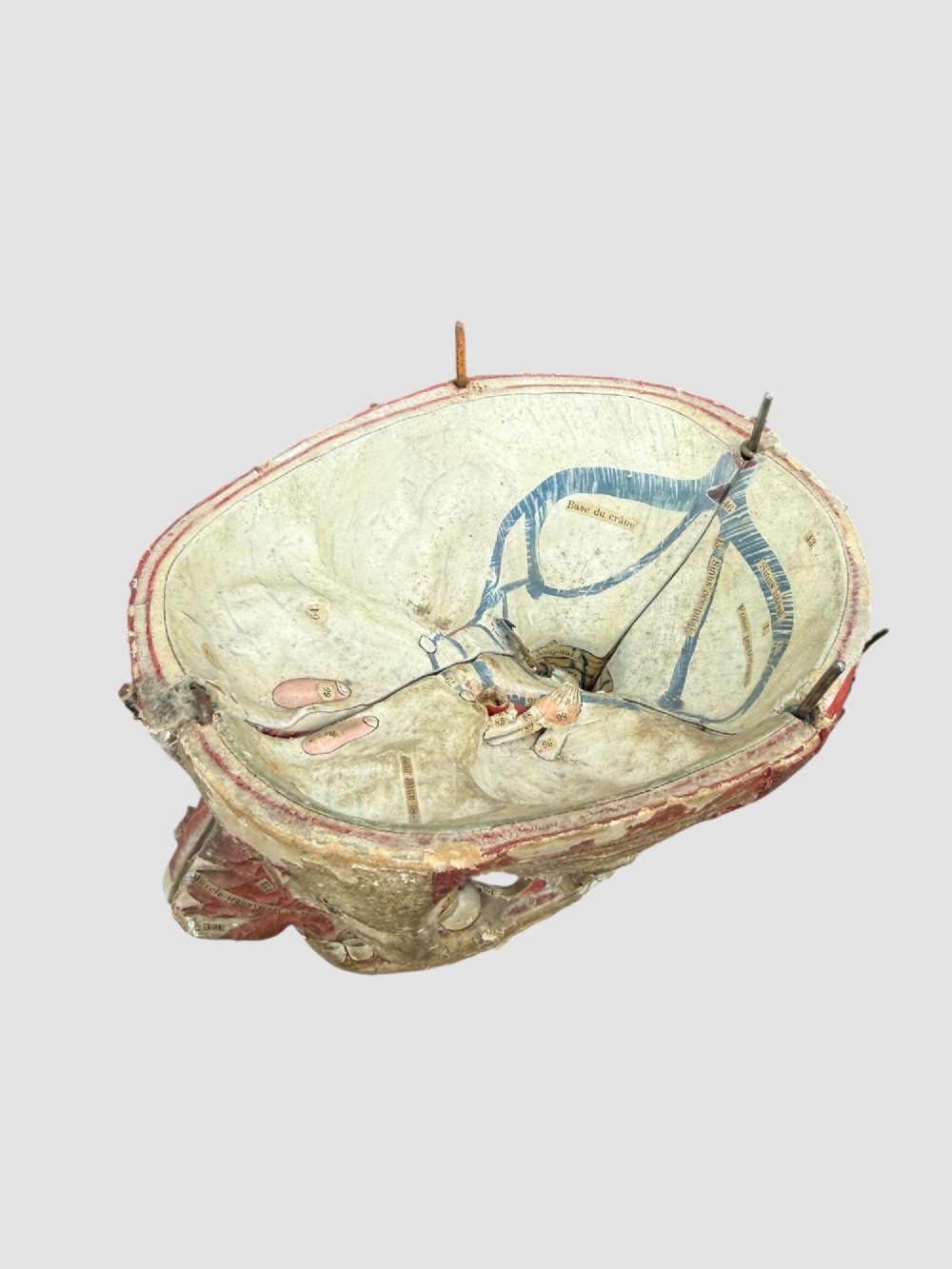 A 19th-century hand-painted French anatomical model depicting human musculature and internal structure mounted on a black cast iron tripod stand. View IV