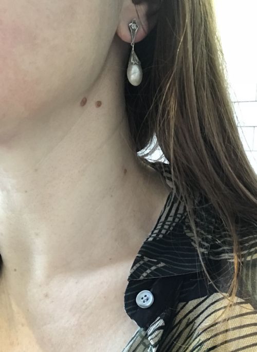 EDWARDIAN NATURAL PEARL AN DIAMOND EARRINGS - ADDITIONAL PHOTO 2