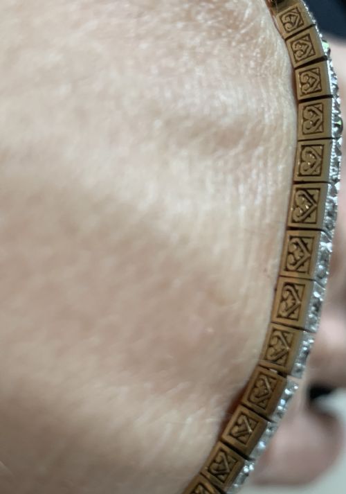 ART DECO DIAMOND BRACELET - ADDITIONAL PHOTO 7