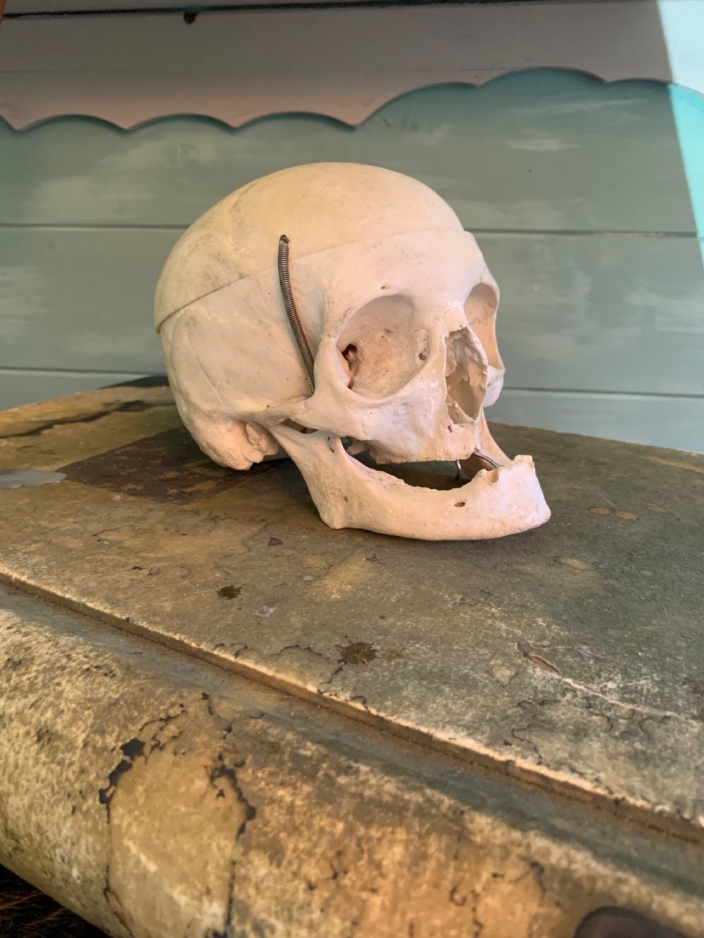 AN EARLY 20th CENTURY MEDICAL SKULL