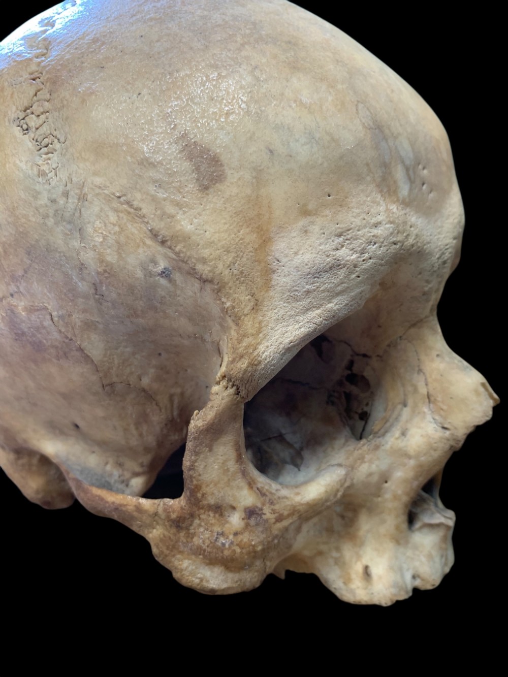 AN ANTIQUE MEDICAL OR TEACHING AID HUMAN SKULL View III