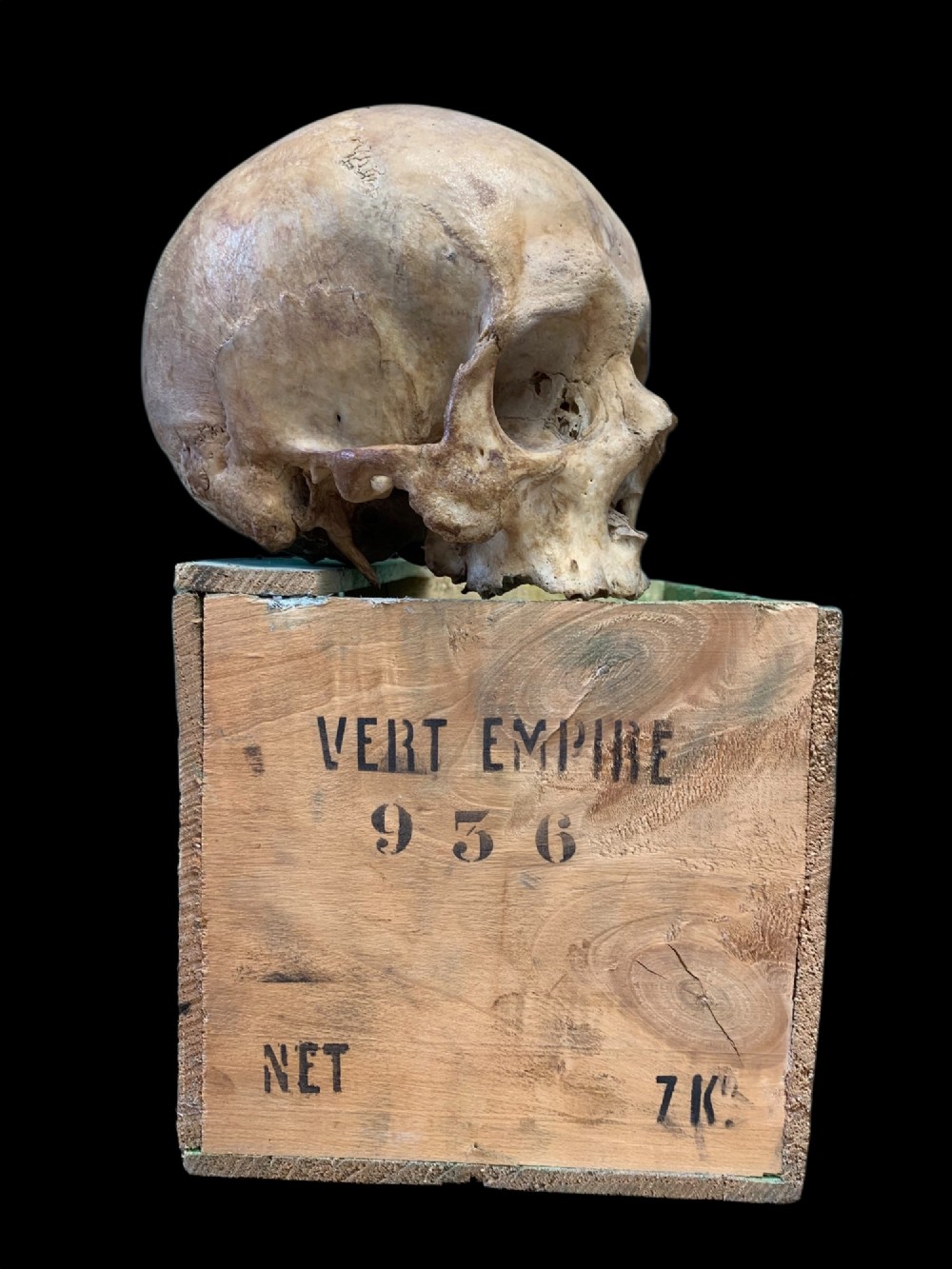 AN ANTIQUE MEDICAL OR TEACHING AID HUMAN SKULL View IV