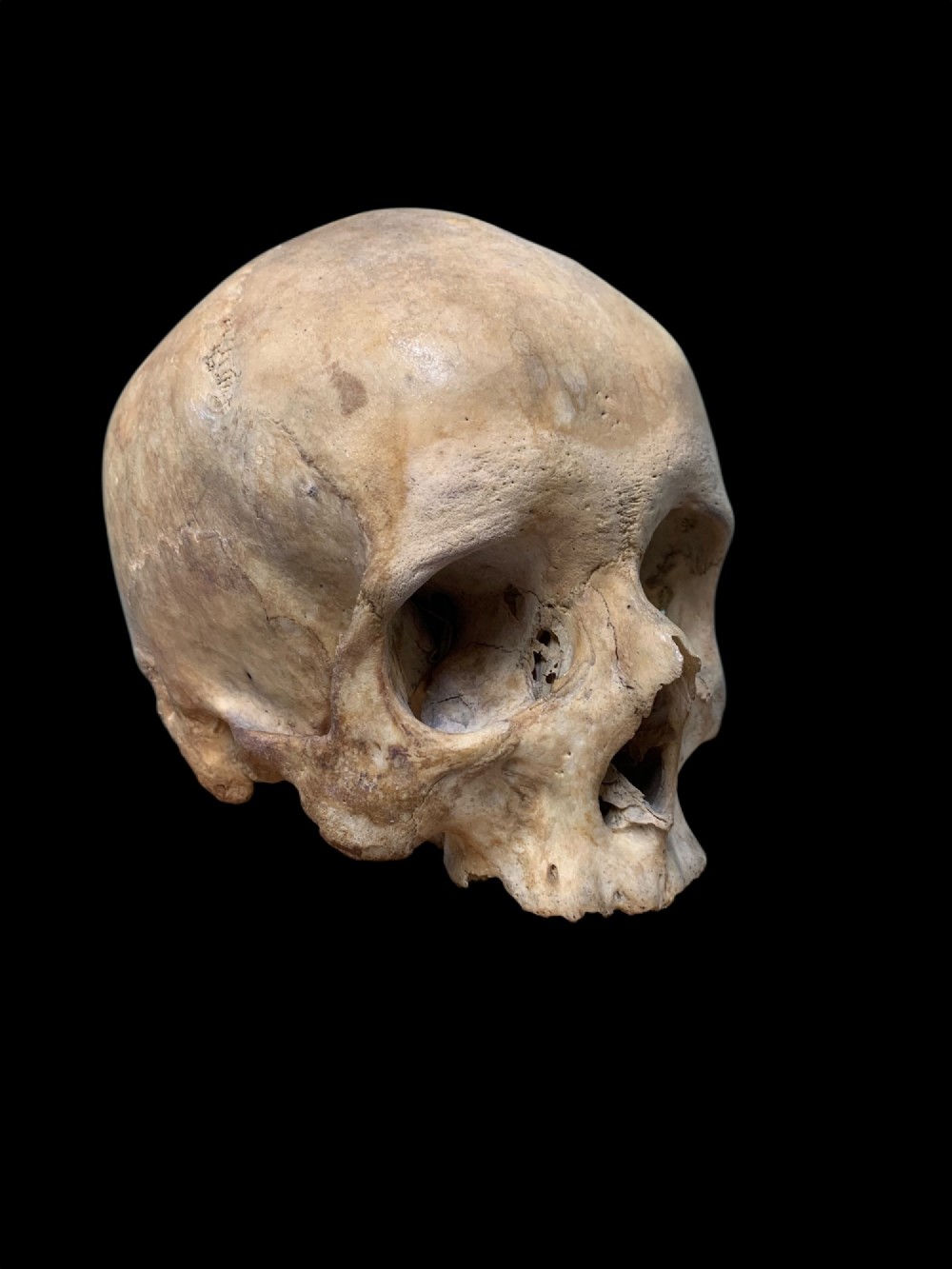 AN ANTIQUE MEDICAL OR TEACHING AID HUMAN SKULL View V