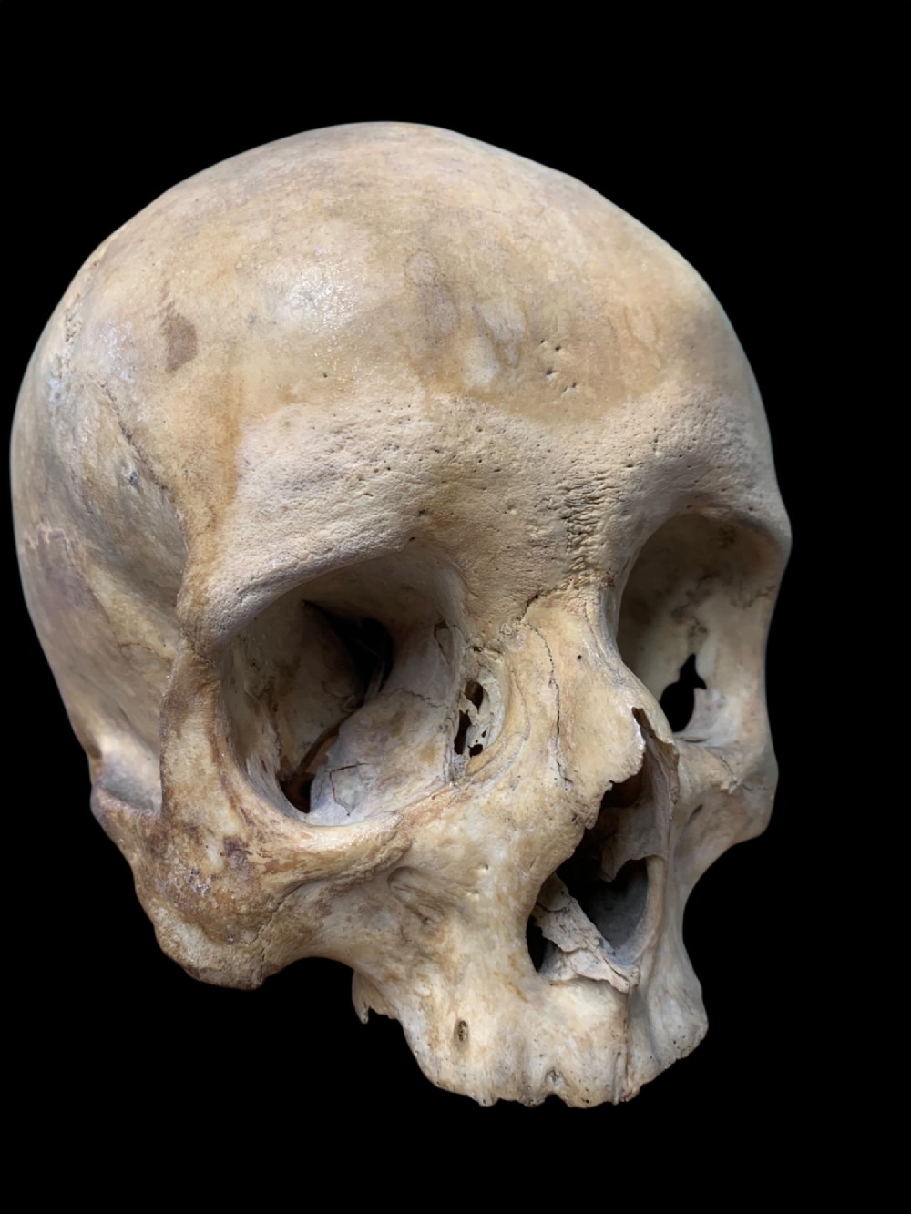 AN ANTIQUE MEDICAL OR TEACHING AID HUMAN SKULL View VII