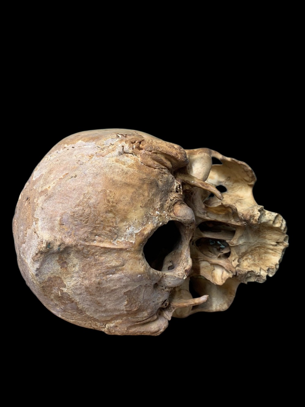 AN ANTIQUE MEDICAL OR TEACHING AID HUMAN SKULL View VIII
