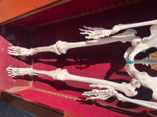 VICTORIAN PINE SINGLE DOOR SKELETON CUPBOARD IN ORIGINAL FINISH WITH LATER SKELETON MODEL - ADDITIONAL PHOTO 8