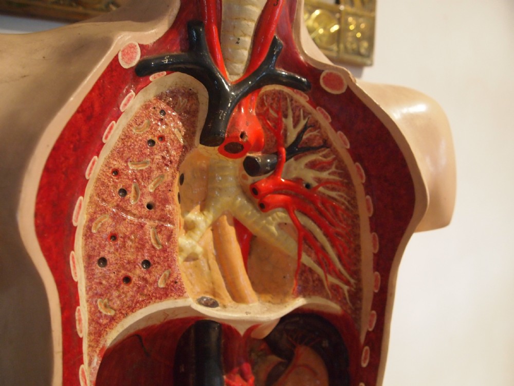 Medical torso model German Hermann Wittmann c1910 View II