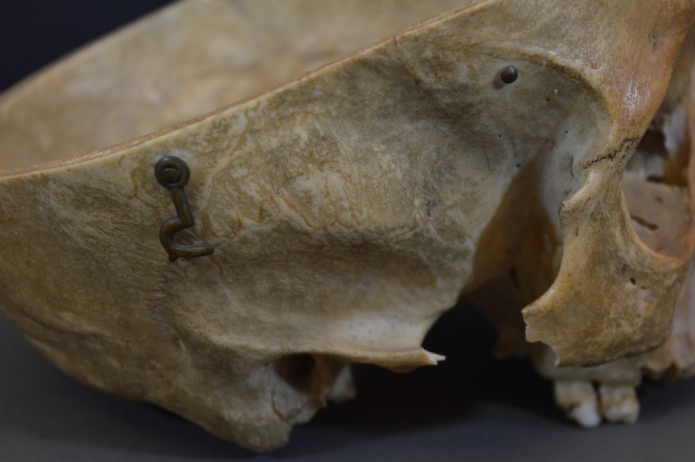 Medical School Human Skull, c1890 View XII