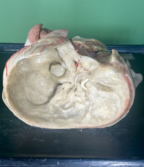 19TH CENTURY ANATOMICAL WAX HEAD MODEL MOUNTED ON FRAMED BOARD - ADDITIONAL PHOTO 13