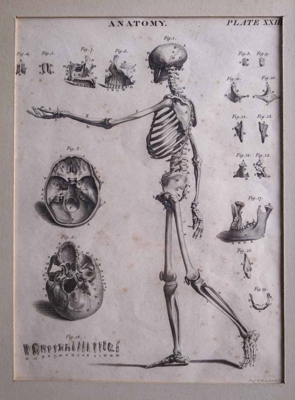An 18th-century copperplate anatomical engraving depicting a profile view of a human skeleton alongside detailed cranial diagrams, displayed within a black wooden frame. View II