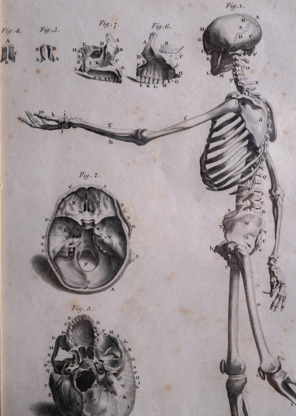 An 18th-century copperplate anatomical engraving depicting a profile view of a human skeleton alongside detailed cranial diagrams, displayed within a black wooden frame. View IV