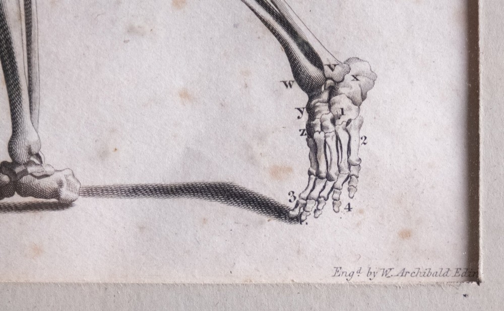 An 18th-century copperplate anatomical engraving depicting a profile view of a human skeleton alongside detailed cranial diagrams, displayed within a black wooden frame. View VI