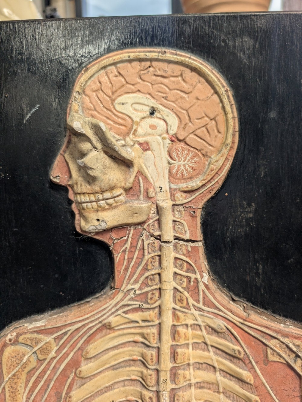 Anatomical Relief Education Model View VI