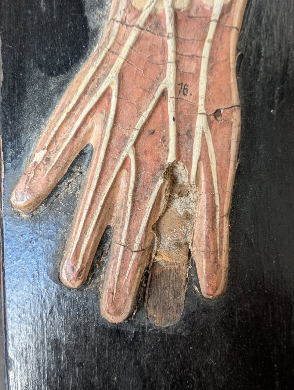 Anatomical Relief Education Model View IX