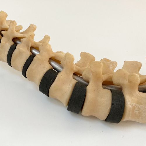 fig 3. Scoliosis Spinal Column Model by Educational & Scientific Plastics Ltd