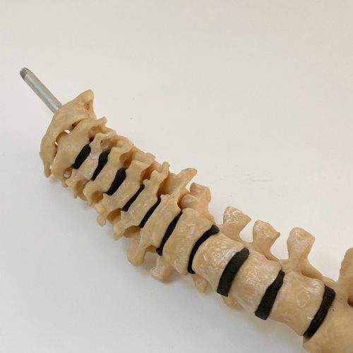 fig 5. Scoliosis Spinal Column Model by Educational & Scientific Plastics Ltd