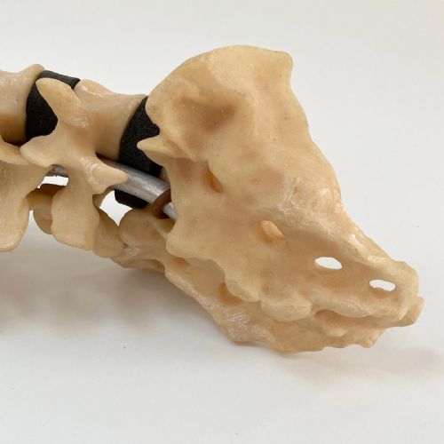 fig 6. Scoliosis Spinal Column Model by Educational & Scientific Plastics Ltd