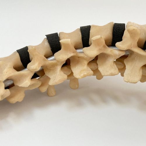 fig 7. Scoliosis Spinal Column Model by Educational & Scientific Plastics Ltd