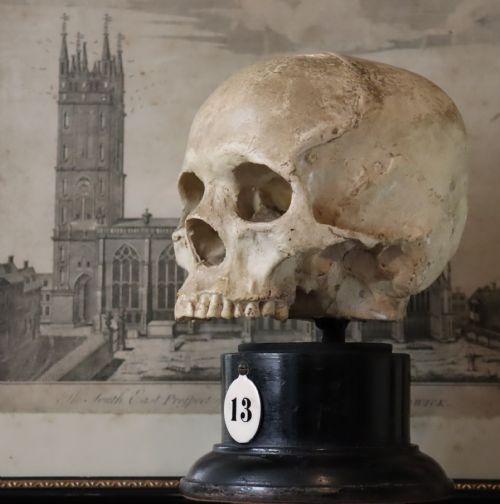 Plaster Model of a Human Skull.  Early 20th Century