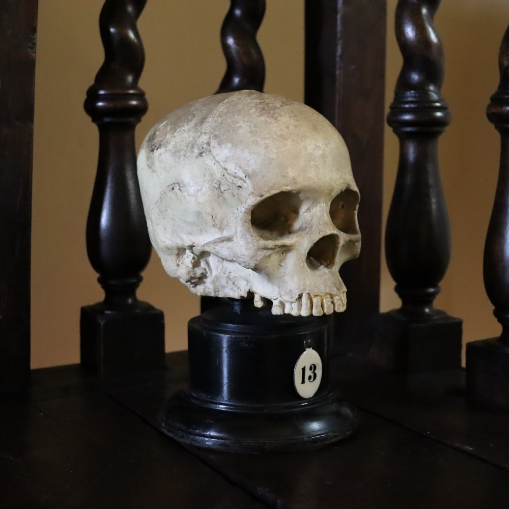 Plaster model of a Human Skull.  Early 20th Century  View II