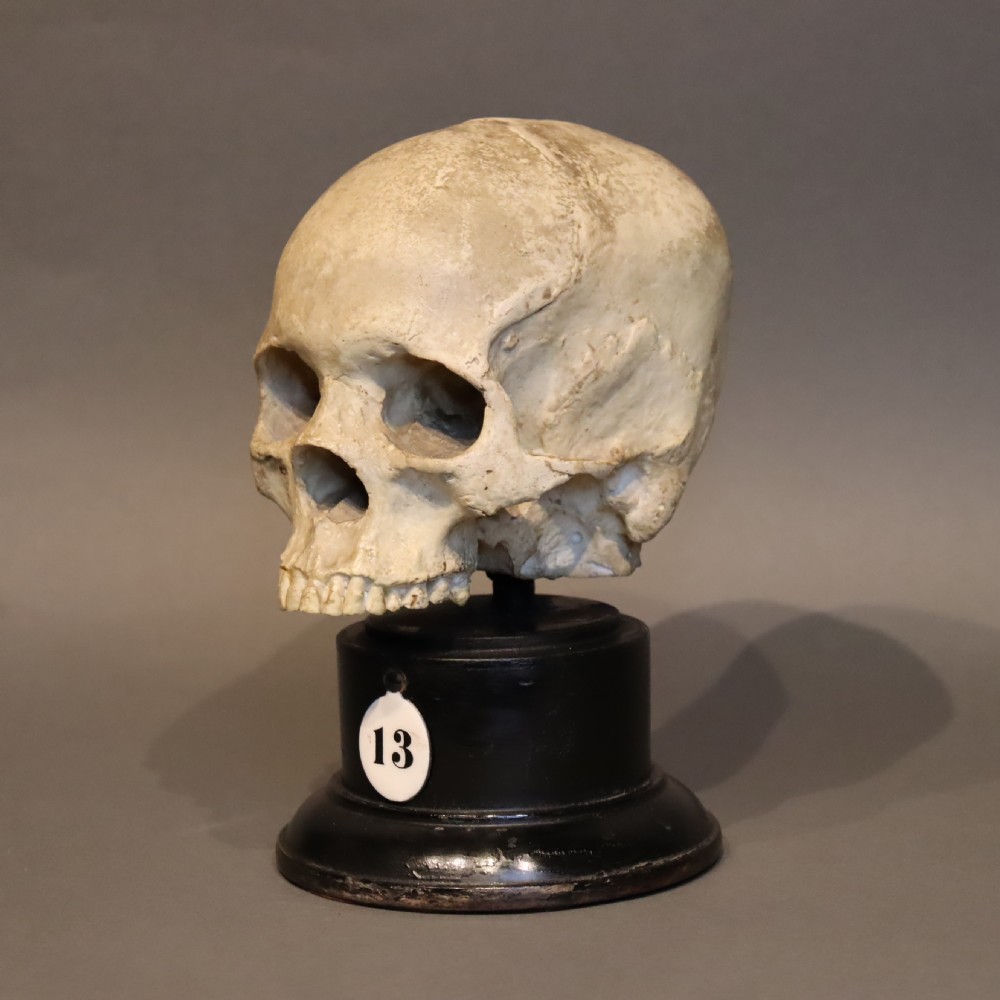 Plaster model of a Human Skull.  Early 20th Century  View VII