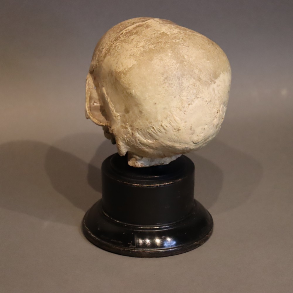 Plaster model of a Human Skull.  Early 20th Century  View VIII