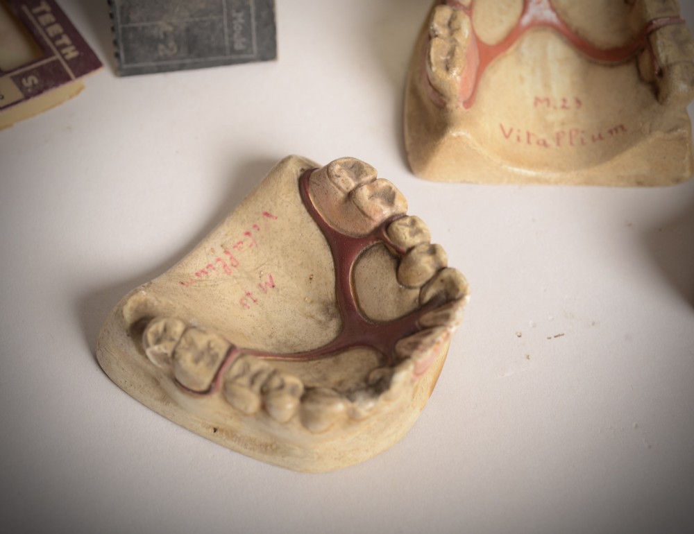 A collection of vintage dental samples featuring sets of porcelain teeth on printed cards, plaster jaw moulds, and an aged metal storage box. View II