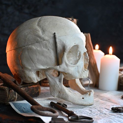 fig 2. An articulated anatomical human skull specimen featuring a cut calvaria connected with metal wire and spring hinges.
