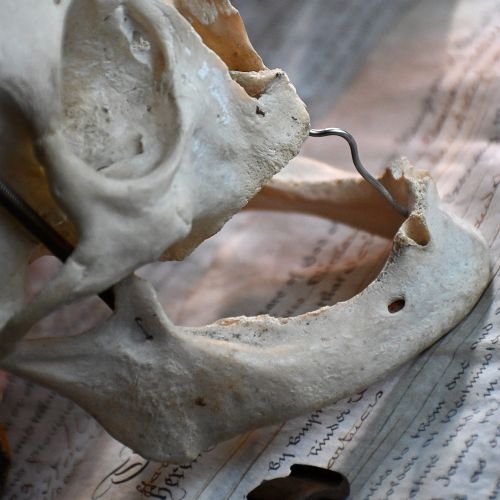fig 3. An articulated anatomical human skull specimen featuring a cut calvaria connected with metal wire and spring hinges.