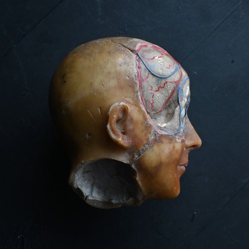 fig 1. An early 20th-century wax anatomical head model featuring a painted phrenological grid on one side and exposed cranial and ocular structures with glass eyes on the other.