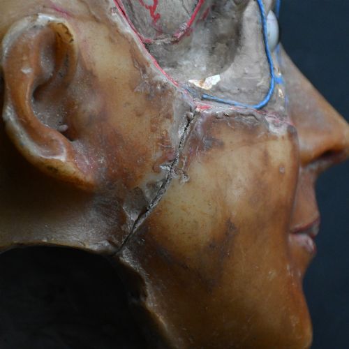 fig 2. An early 20th-century wax anatomical head model featuring a painted phrenological grid on one side and exposed cranial and ocular structures with glass eyes on the other.