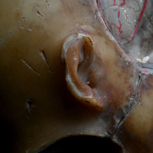 fig 3. An early 20th-century wax anatomical head model featuring a painted phrenological grid on one side and exposed cranial and ocular structures with glass eyes on the other.
