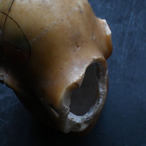 fig 6. An early 20th-century wax anatomical head model featuring a painted phrenological grid on one side and exposed cranial and ocular structures with glass eyes on the other.