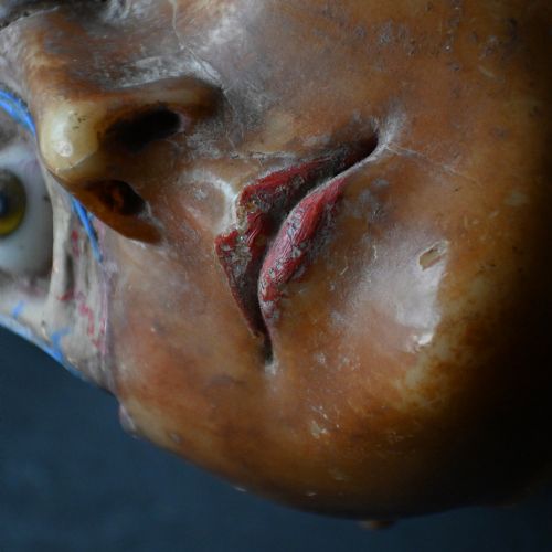 fig 9. An early 20th-century wax anatomical head model featuring a painted phrenological grid on one side and exposed cranial and ocular structures with glass eyes on the other.