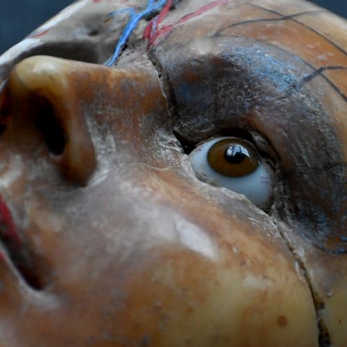 fig 10. An early 20th-century wax anatomical head model featuring a painted phrenological grid on one side and exposed cranial and ocular structures with glass eyes on the other.