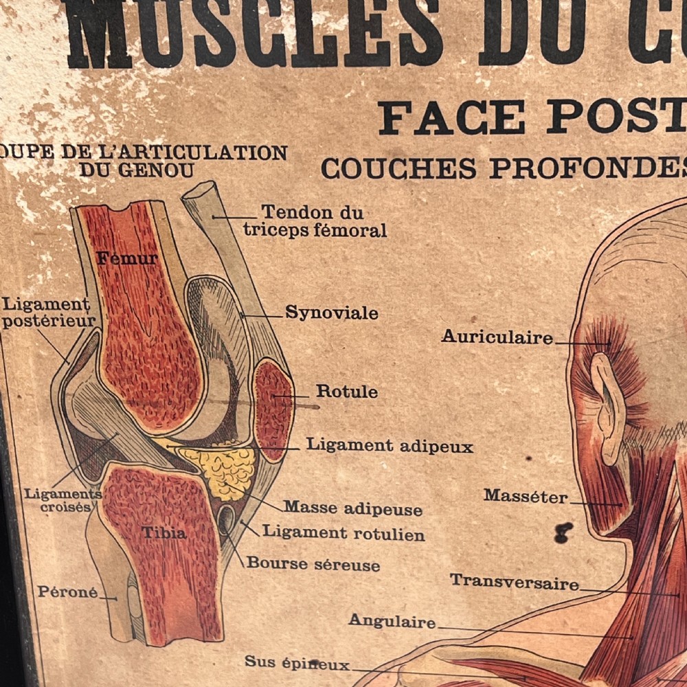 Large Vintage French Muscular System Anatomy Poster, Framed View IV