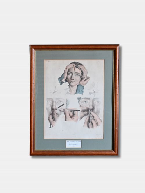 C 1850 FRAMED HANDCOLOURED LITHOGRAPH MEDICAL PROCEDURES FRENCH
